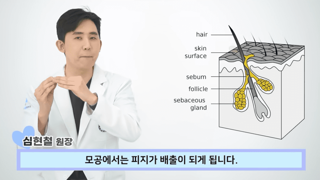 모공 축소하는 방법